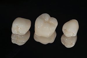 three dental crowns against a black background 